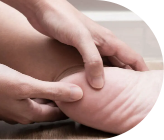 Dor no calcanhar? Saiba diferenciar problemas como entorse, luxação e outras lesões locais!